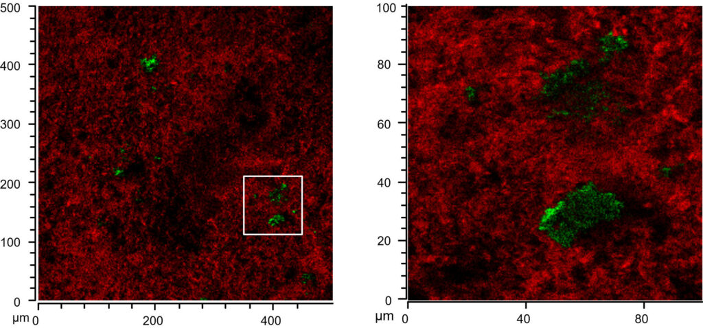 ToF Sims scans of a 500 x 500 and a 100 x 100 um section showing intensive lipid signals