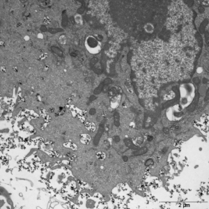 TEM shows the cellular uptake of ferrite nanoparticles